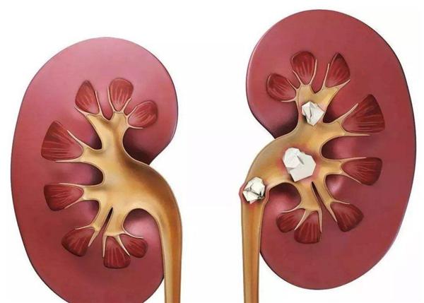 橘子吃多了會怎樣，不僅會上火還可能中毒